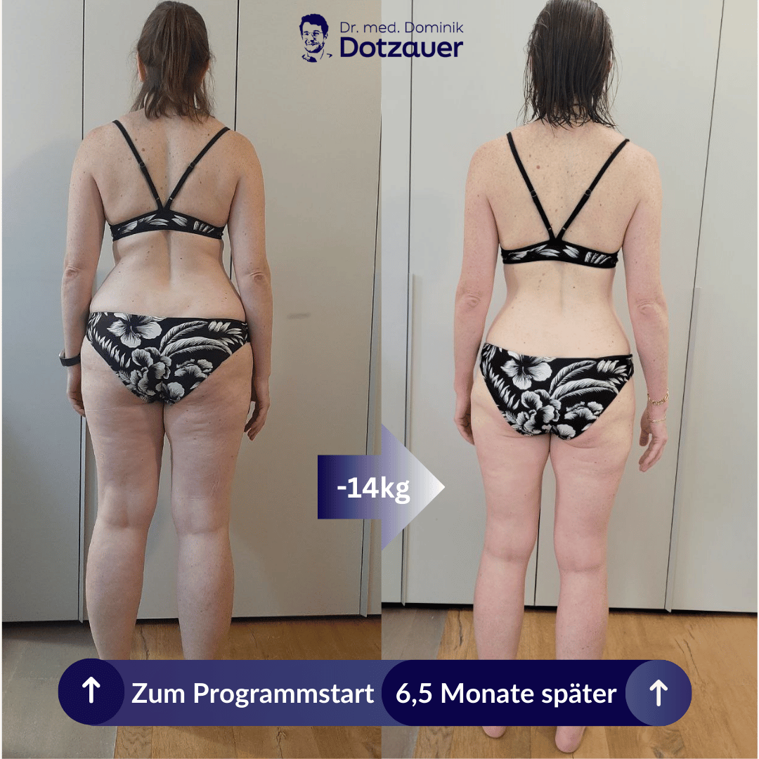 Klientin vorher und nachher, Rückansicht, minus 14 Kilo nach 6,5 Monaten