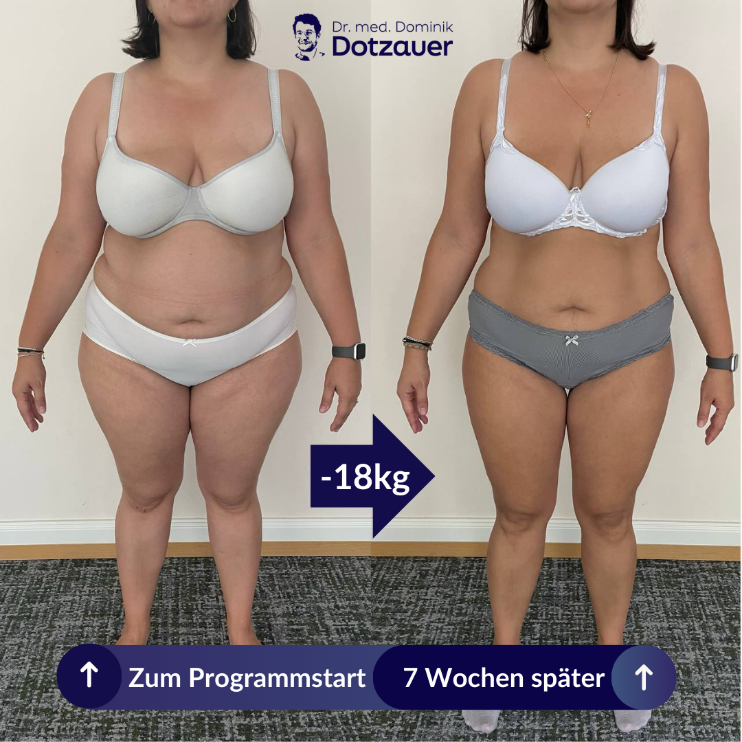 Klientin vorher und nachher, Frontalansicht, minus 18 Kilo nach 7 Wochen
