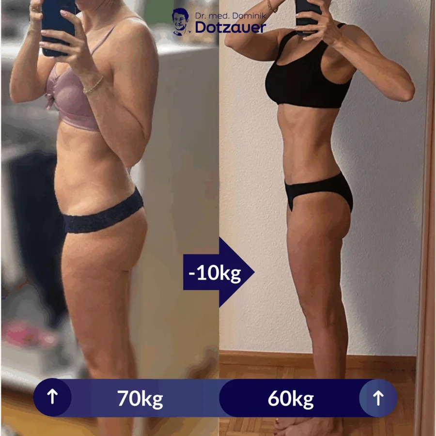 Klientin vorher und nachher, Seitenansicht, von 70 auf 60 Kilo