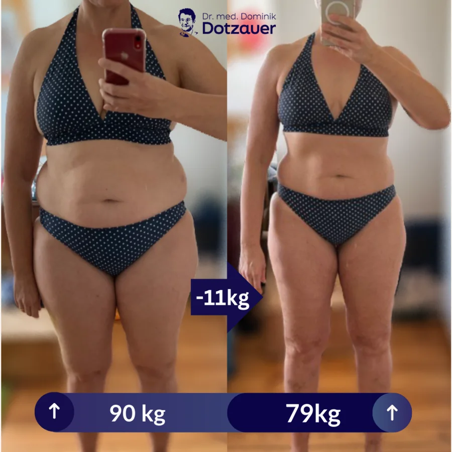 Klientin vorher und nachher, von 90 auf 79 Kilo in 3 Monaten