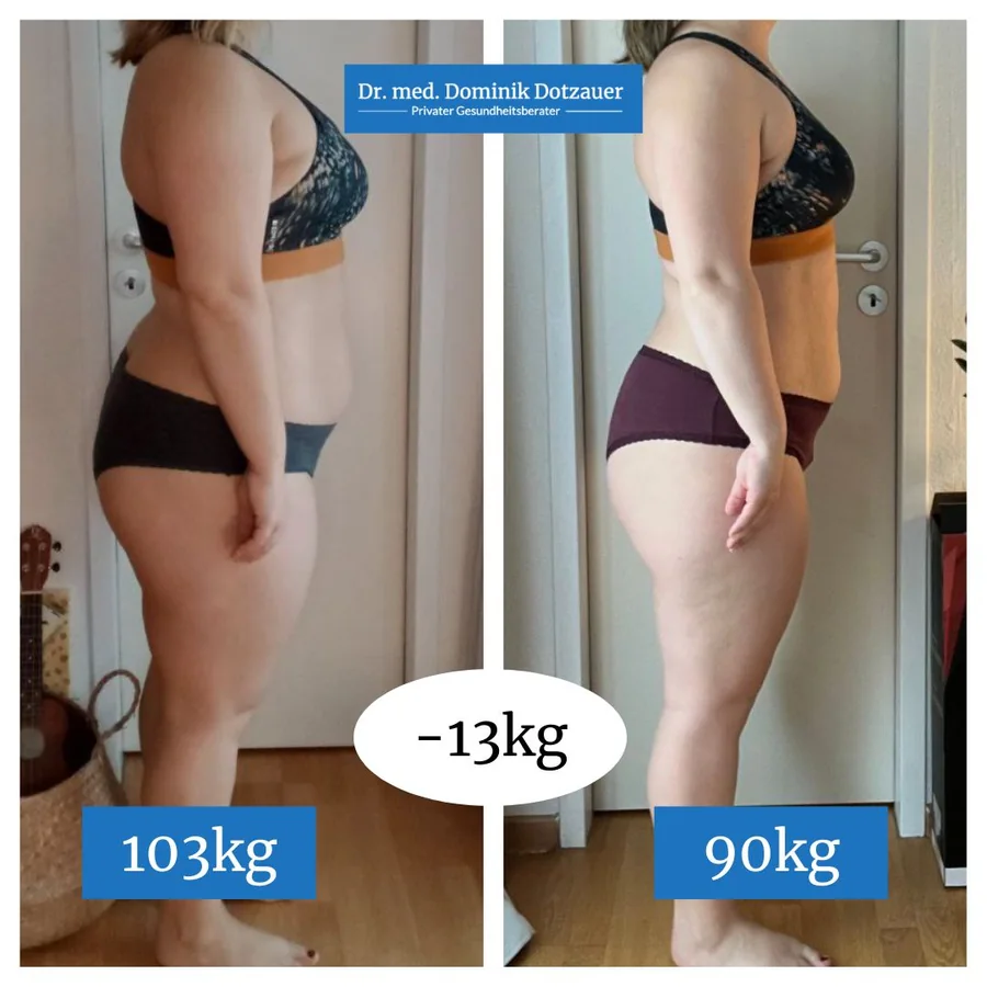Klientin vorher und nachher, Seitenansicht, von 103 auf 90 Kilo in 5 Monaten