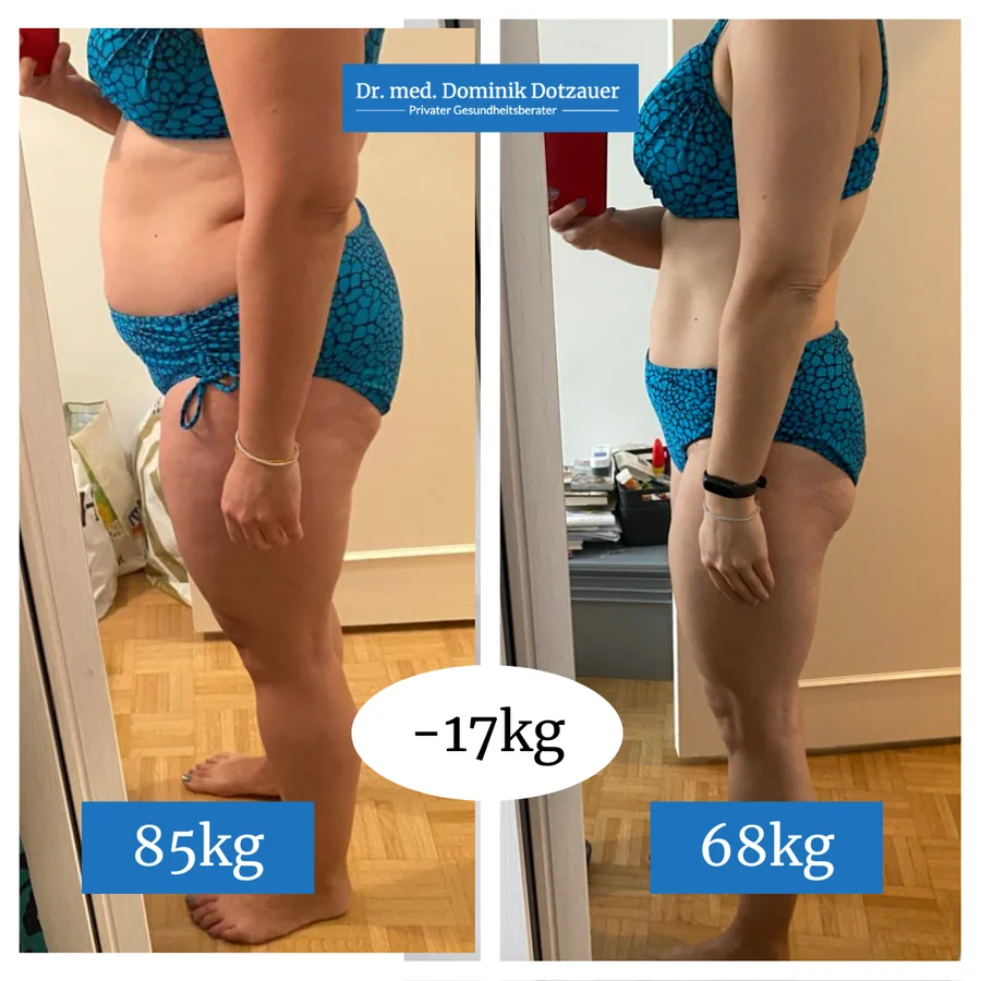 Klientin vorher und nachher, Seitenansicht, von 85 auf 68 Kilo